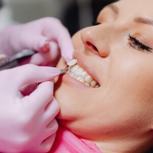 Dental Veneers - South Boston Dental Care