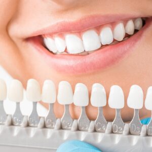 One Day Dental Crowns - South Boston Dental Care