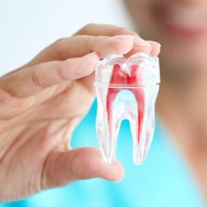 Root Canal Treatment - South Boston Dental Care