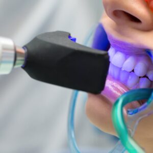 Teeth Whitening - South Boston Dental Care