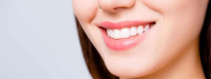 Teeth Whitening Treatment